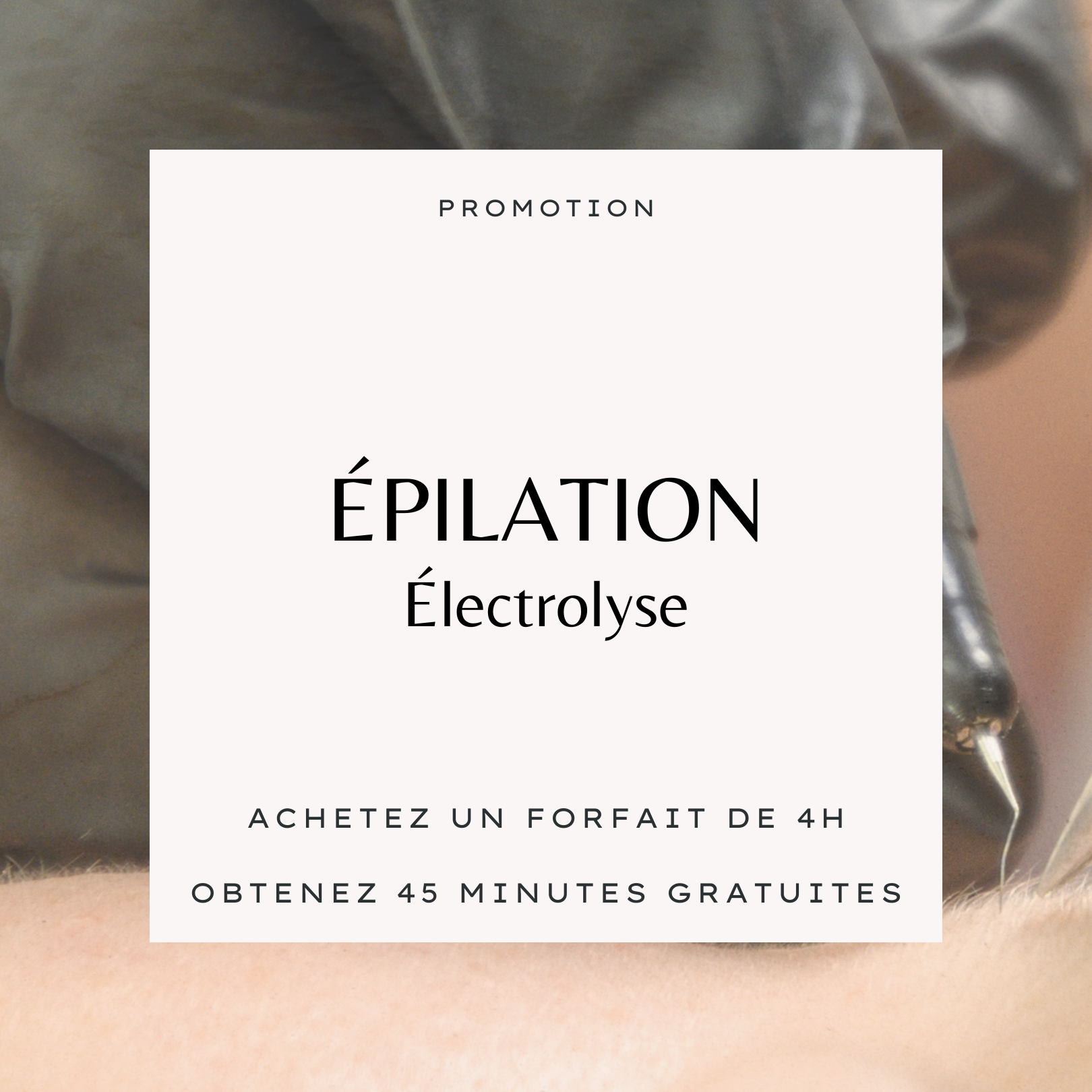 (PROMO DURÉE LIMITÉE) Bloc de temps - Électrolyse 45 minutes